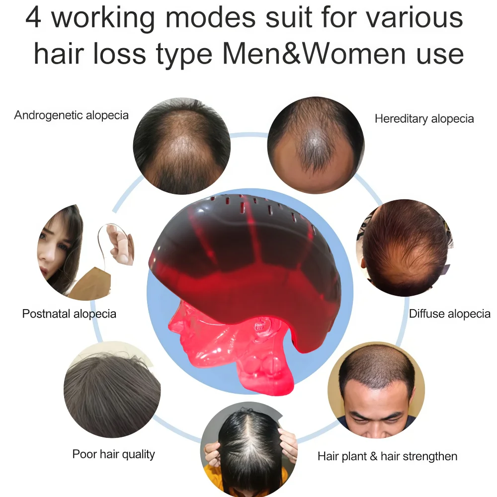 Профессиональный шлем для роста волос с красным светом, 6750 мВт, 300 диодов, лазерная терапия, 90+210 светодиодов для предотвращения выпадения волос
Профессиональный шлем для роста волос с красным светом, 6750 мВт, 300 диодов, лазерная терапия, 90+210 светодиодов для предотвращения выпадения волос