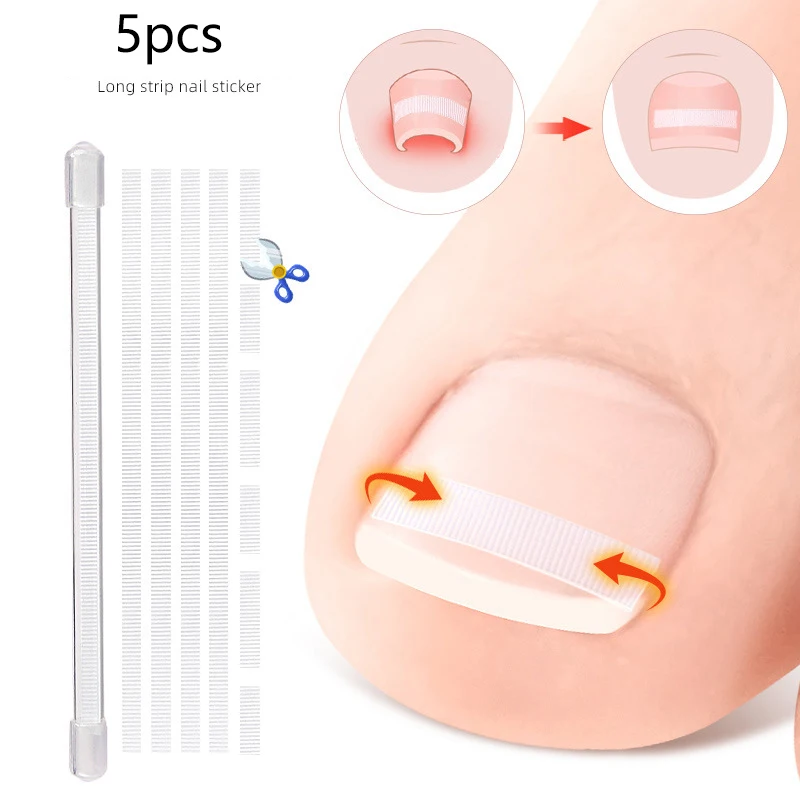 5Pcs Ingrown Toe Nail Treatment Ingrown Toenail Correction Tool Elastic Patch Sticker Straightening Clip Brace Pedicure Tools
5Pcs Ingrown Toe Nail Treatment Ingrown Toenail Correction Tool Elastic Patch Sticker Straightening Clip Brace Pedicure Tools