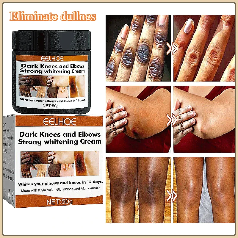Dark Colored Quick Whitening Cream Skinpowerful Stain Remover Knuckles Correction for Dark for Knuckles Elbows and Knees
Dark Colored Quick Whitening Cream Skinpowerful Stain Remover Knuckles Correction for Dark for Knuckles Elbows and Knees