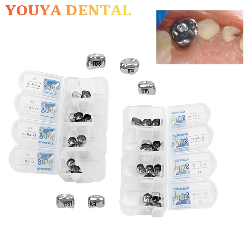 5pcs/box Dental Children Crown Stainless Steel Primary Molar Filler Stainless Steel Preformed Crown Dental Material
5pcs/box Dental Children Crown Stainless Steel Primary Molar Filler Stainless Steel Preformed Crown Dental Material