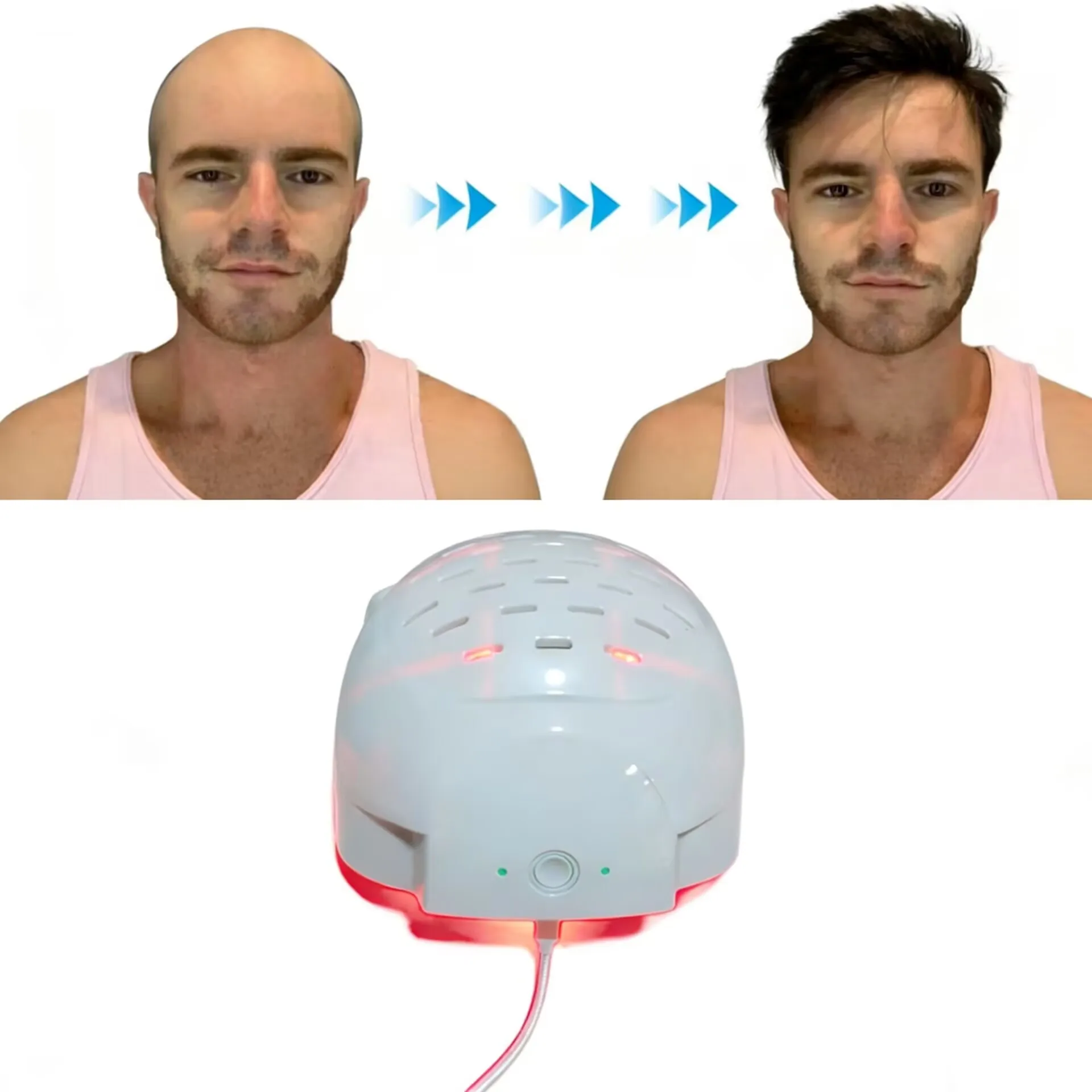 Hair Regrowth Light Therapy Device Hair Growth Cap Anti Hair Loss Laser Helmet Hat Treatment Hat Machine
Hair Regrowth Light Therapy Device Hair Growth Cap Anti Hair Loss Laser Helmet Hat Treatment Hat Machine