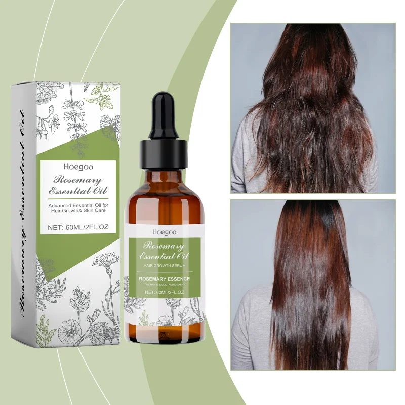 Repairing Rosemary Hair Oil - Nourishes Scalp Strengthens Hair Improves Split Ends Repairs Damage Long-Lasting Care Non-Greasy
Repairing Rosemary Hair Oil - Nourishes Scalp Strengthens Hair Improves Split Ends Repairs Damage Long-Lasting Care Non-Greasy