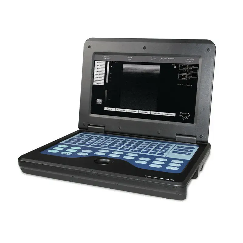 Ультразвуковой сканер CONTEC CMS600P2, портативная машина, ультразвуковые диагностические системы с выпуклым зондом
Ультразвуковой сканер CONTEC CMS600P2, портативная машина, ультразвуковые диагностические системы с выпуклым зондом