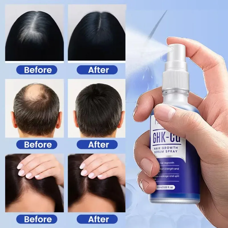 GHK-Cu Blue Copper Peptide Hair Growth Spray Deeply Nourishes Scalp Activates Follicles Reduce Hair Loss Essences Spray/Essense
GHK-Cu Blue Copper Peptide Hair Growth Spray Deeply Nourishes Scalp Activates Follicles Reduce Hair Loss Essences Spray/Essense