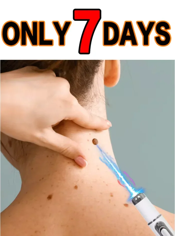 Модернизированные бородавки 2-го поколения ремонт корня бородавок
Модернизированные бородавки 2-го поколения ремонт корня бородавок