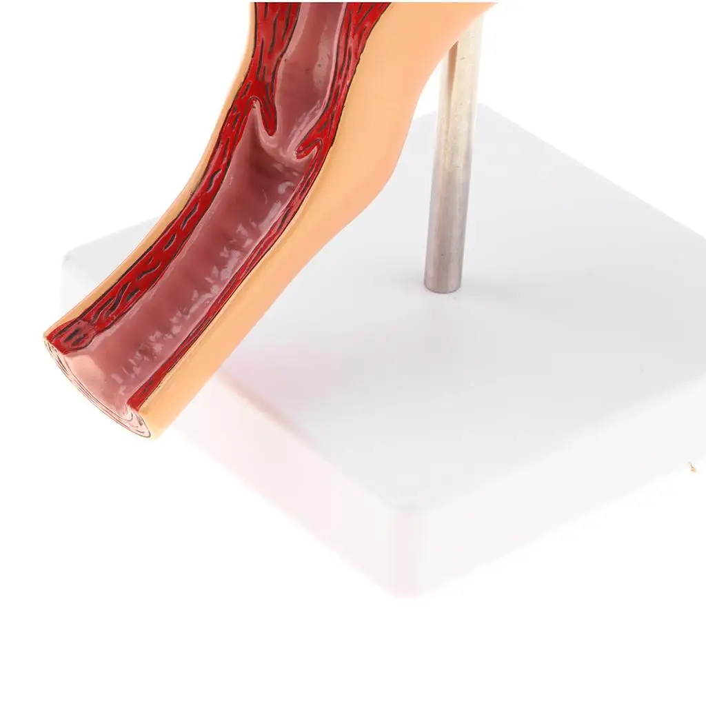 A06RP Анатомическая модель женского репродуктивного органа, матки, вагины, модель женской болезни, анатомическая модель человека, обучающие инструменты
A06RP Анатомическая модель женского репродуктивного органа, матки, вагины, модель женской болезни, анатомическая модель человека, обучающие инструменты