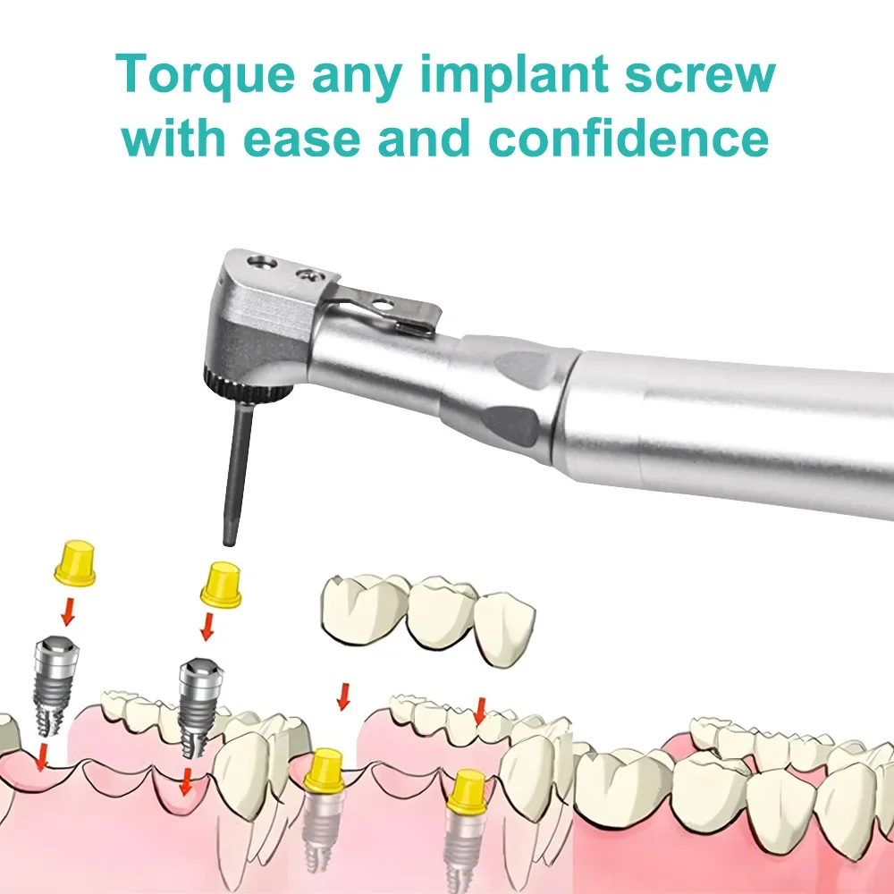 ELIJAH Dental Implant Wrench Dentistry 5~35N/cm Torque Gear Ratchet Screwdriver Buckle Latch Head Handpiece Dentist Equipment
ELIJAH Dental Implant Wrench Dentistry 5~35N/cm Torque Gear Ratchet Screwdriver Buckle Latch Head Handpiece Dentist Equipment