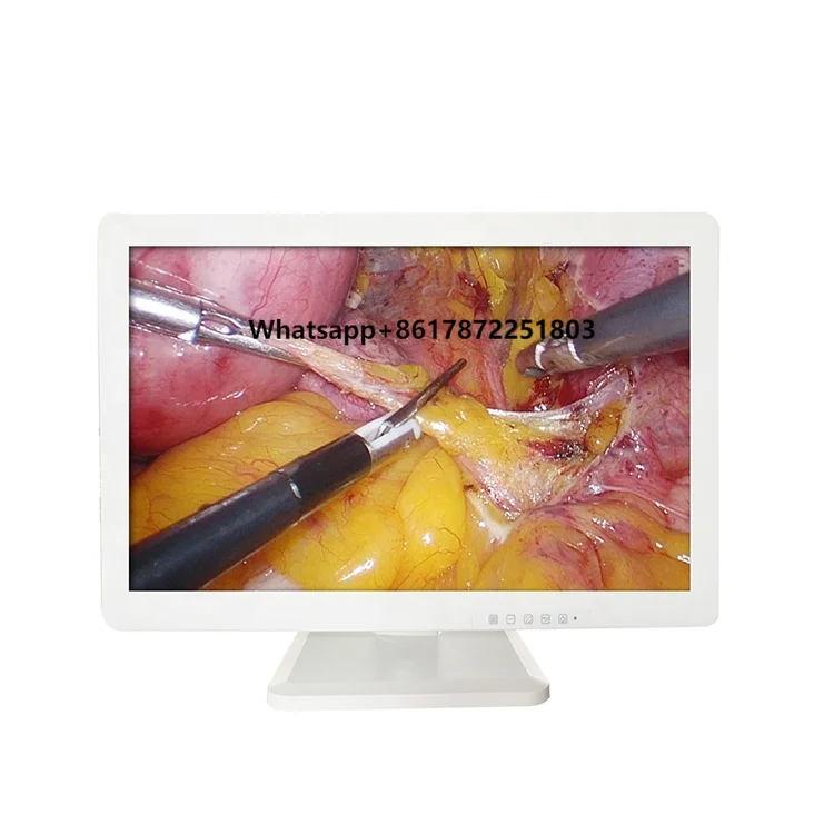 Multifunctional Medical Portable Multi-Parameter Patient for Endoscope Surgery
Multifunctional Medical Portable Multi-Parameter Patient for Endoscope Surgery