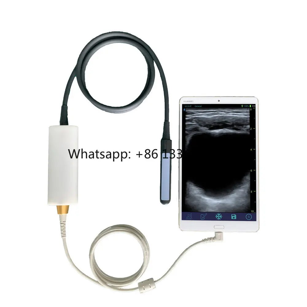 Портативная USB-ветеринарная система для обнаружения коровы, крупного рогатого скота с поставщиком ректального линейного зонда
Портативная USB-ветеринарная система для обнаружения коровы, крупного рогатого скота с поставщиком ректального линейного зонда