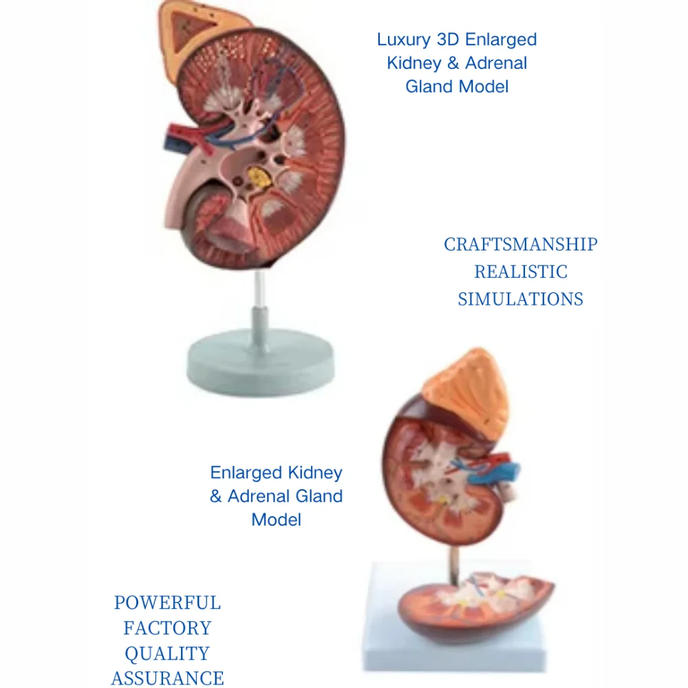 Luxury 3D Enlarged Kidney and Adrenal Gland Model Renal Anatomy Simulator for Medical Teaching Nursing Training Clinic Demonstra
Luxury 3D Enlarged Kidney and Adrenal Gland Model Renal Anatomy Simulator for Medical Teaching Nursing Training Clinic Demonstra