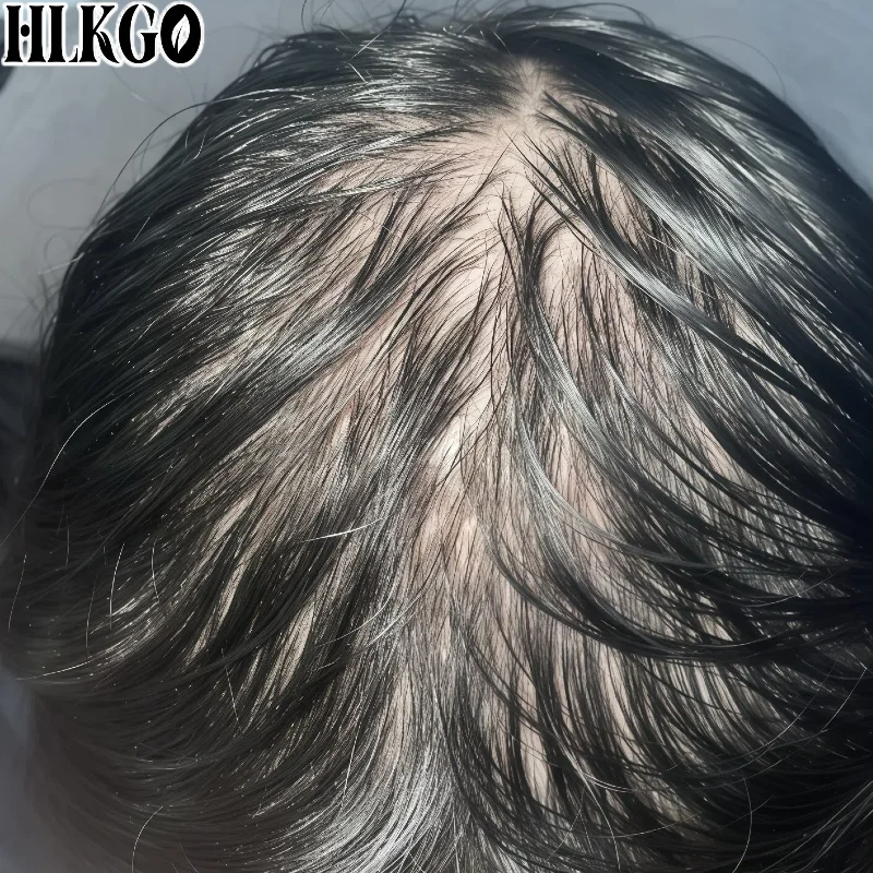 Best 90 Laser Diodes 210 LED Hair Growth Device, 6750mW Max Power for Male Female Pattern Baldness Regrowth Therapy
Best 90 Laser Diodes 210 LED Hair Growth Device, 6750mW Max Power for Male Female Pattern Baldness Regrowth Therapy