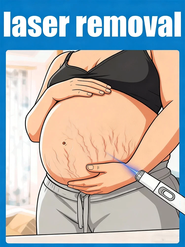 2st ᵍᵉⁿᵉʳᵃᵗⁱᵒⁿ ᵘᵖᵍʳᵃᵈᵉᵈ stretch marks ⸴ ʳᵉpᵃⁱʳ sᶜᵃʳˢ ʳᵒoᵗ ⸴ ᑫᵘⁱᶜᵏˡʸ
2st ᵍᵉⁿᵉʳᵃᵗⁱᵒⁿ ᵘᵖᵍʳᵃᵈᵉᵈ stretch marks ⸴ ʳᵉpᵃⁱʳ sᶜᵃʳˢ ʳᵒoᵗ ⸴ ᑫᵘⁱᶜᵏˡʸ