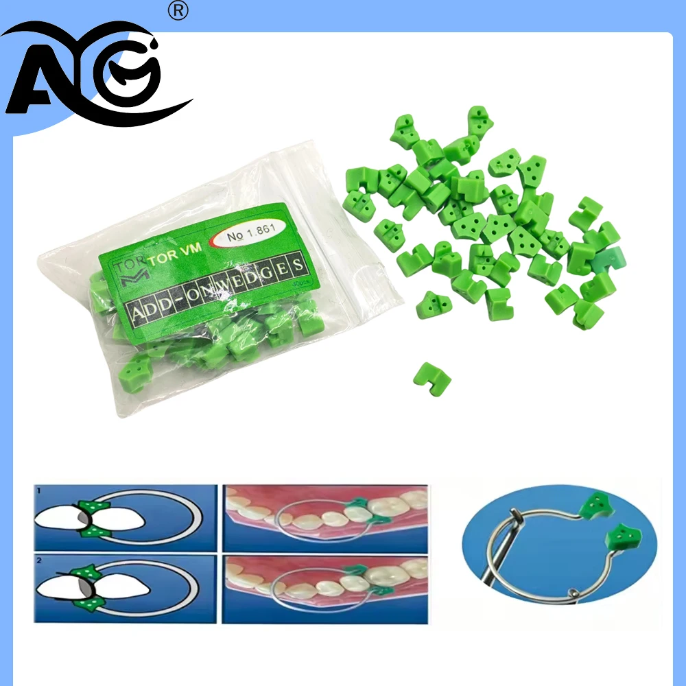 AG Silicone Add On Wedges Rubber Silicone Sectional Contoured Dentistry Restoration Materials Can Heat Treatment Up To 150 °C
AG Silicone Add On Wedges Rubber Silicone Sectional Contoured Dentistry Restoration Materials Can Heat Treatment Up To 150 °C