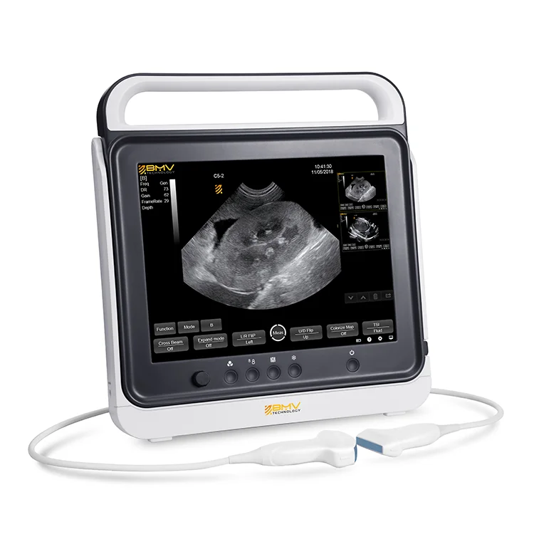 Large Touch Screen Veterinary Ultrasound Machine Scanner for Dogs Cats Sheep Horses
Large Touch Screen Veterinary Ultrasound Machine Scanner for Dogs Cats Sheep Horses