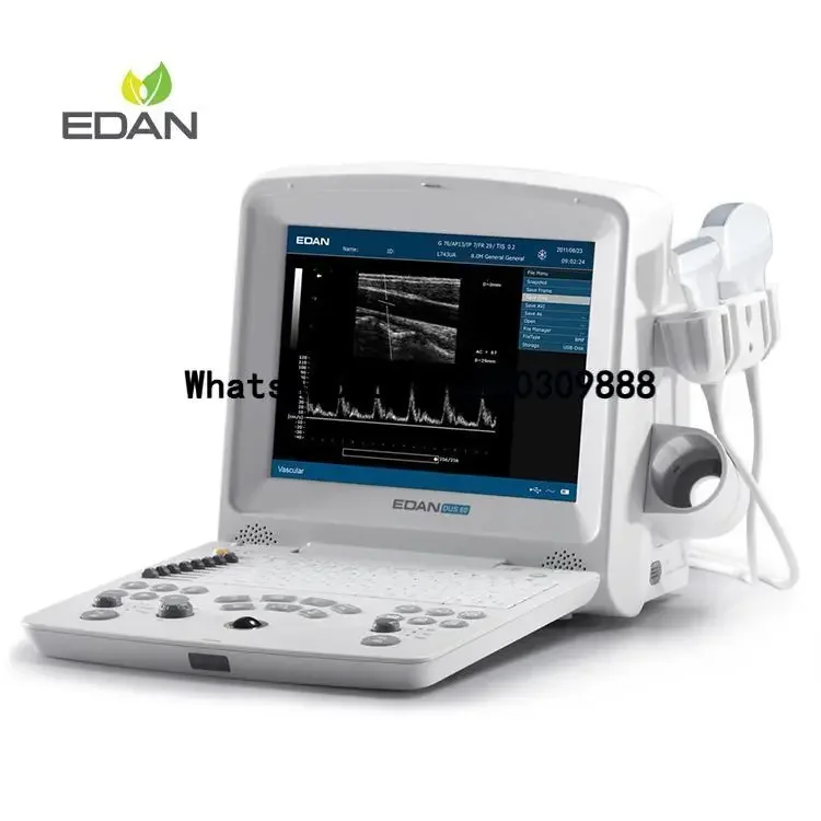 Edan-DUS-60 Portable Medical Ultrasonido Sonografo Portatil Ecografo Edan-DUS-60 Ultrasound Machine
Edan-DUS-60 Portable Medical Ultrasonido Sonografo Portatil Ecografo Edan-DUS-60 Ultrasound Machine