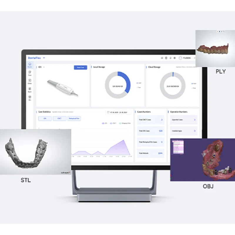 FUSSEN S6500 Dental Digital Impression High Performance Intraoral 3D-Scanner with Scanning Real Color CAD/CAM
FUSSEN S6500 Dental Digital Impression High Performance Intraoral 3D-Scanner with Scanning Real Color CAD/CAM