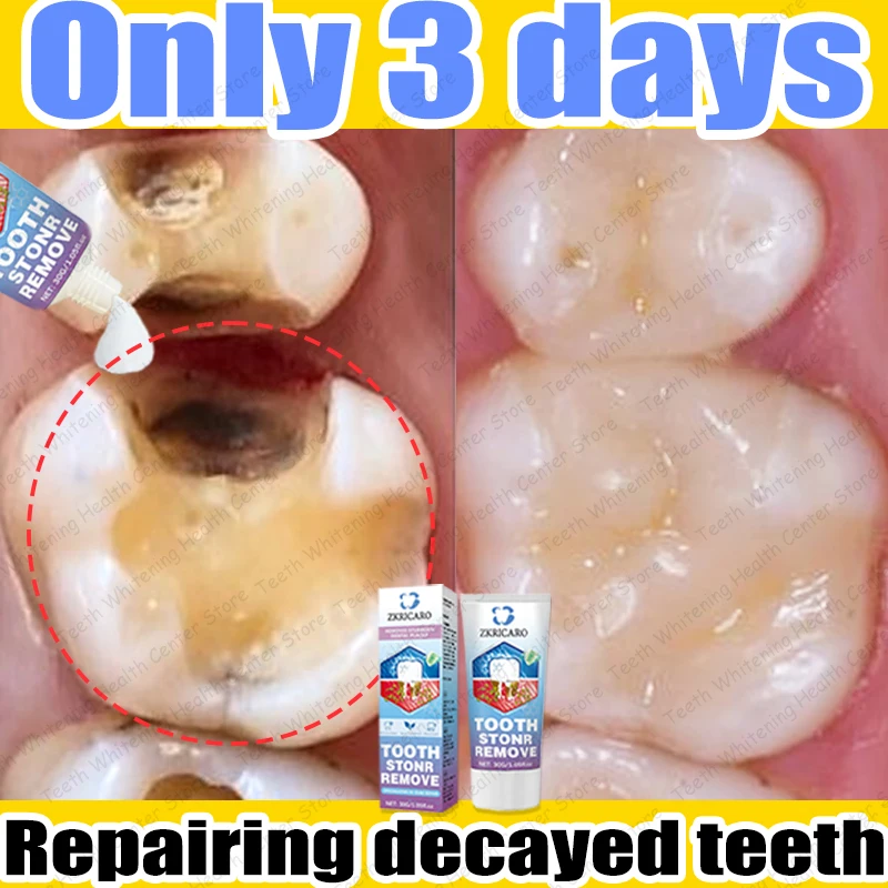 Cleaning Teeth,Repairing decayed teeth
Cleaning Teeth,Repairing decayed teeth