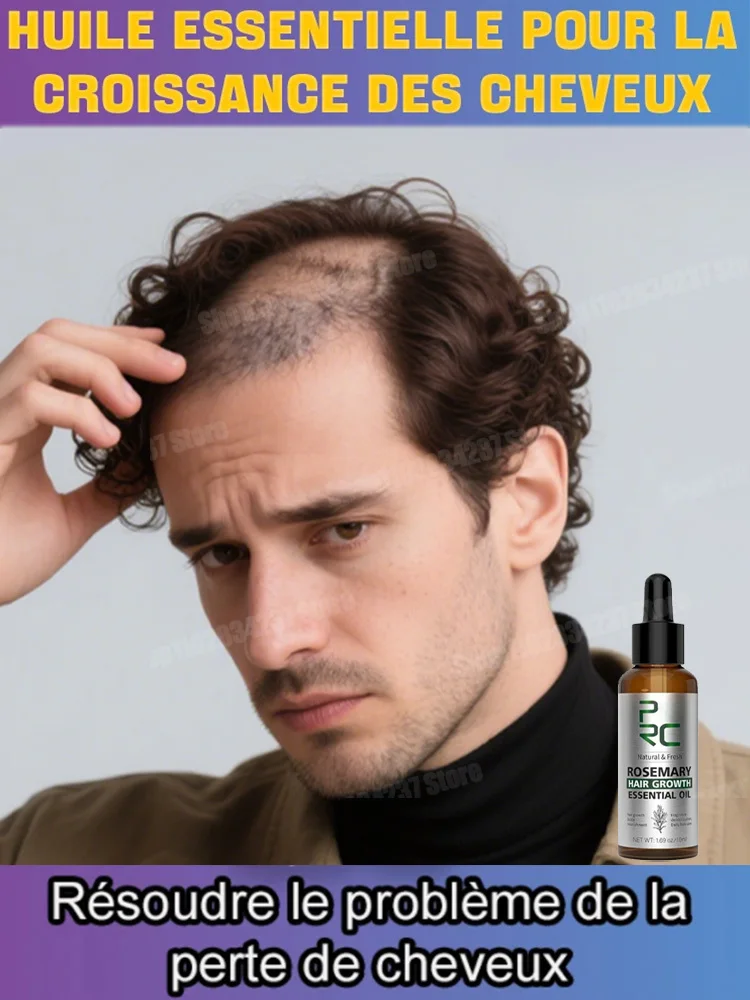 Hair Care Oil for Men and Women, Hair Loss Prevention Essence with Natural Hair Growth Properties
Hair Care Oil for Men and Women, Hair Loss Prevention Essence with Natural Hair Growth Properties