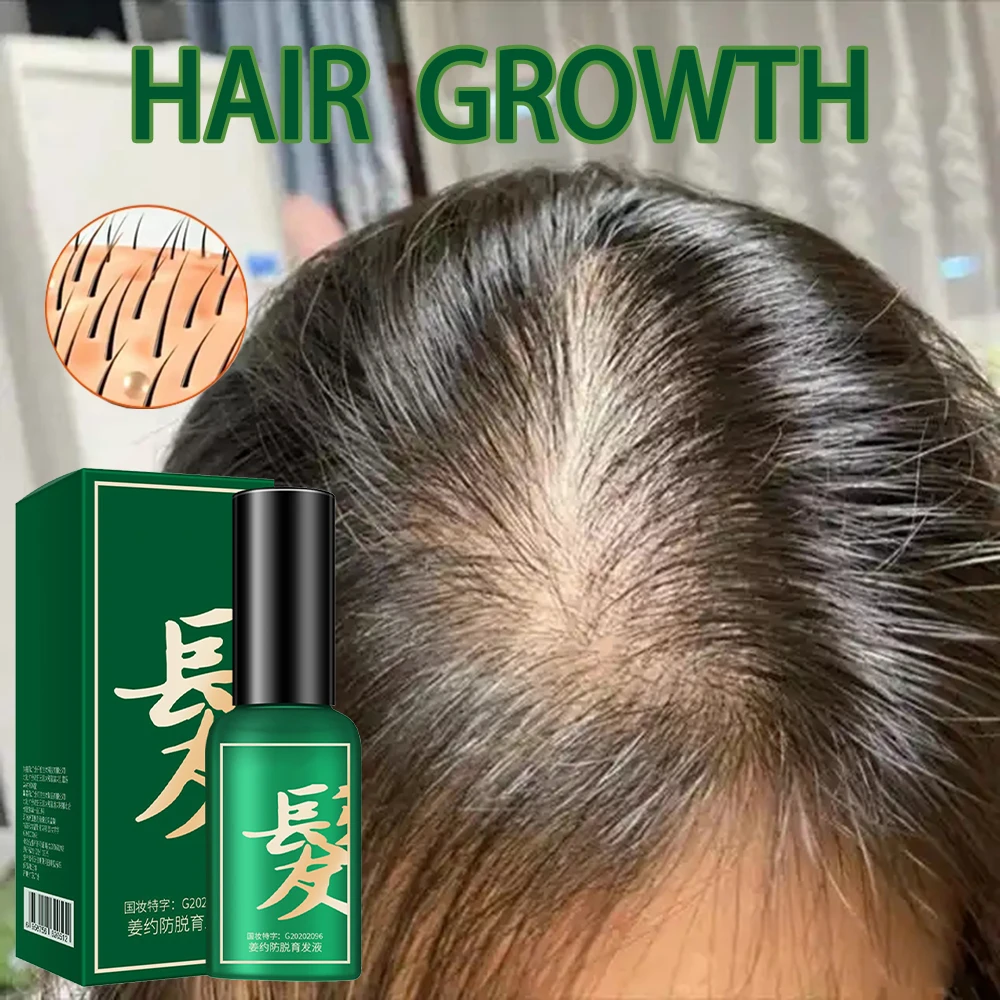 Hair Growth Fluid Effective Repair Damaged Hair Nourish Roots Fast Treatment Grow Hair Ginger Care Health Spray
Hair Growth Fluid Effective Repair Damaged Hair Nourish Roots Fast Treatment Grow Hair Ginger Care Health Spray