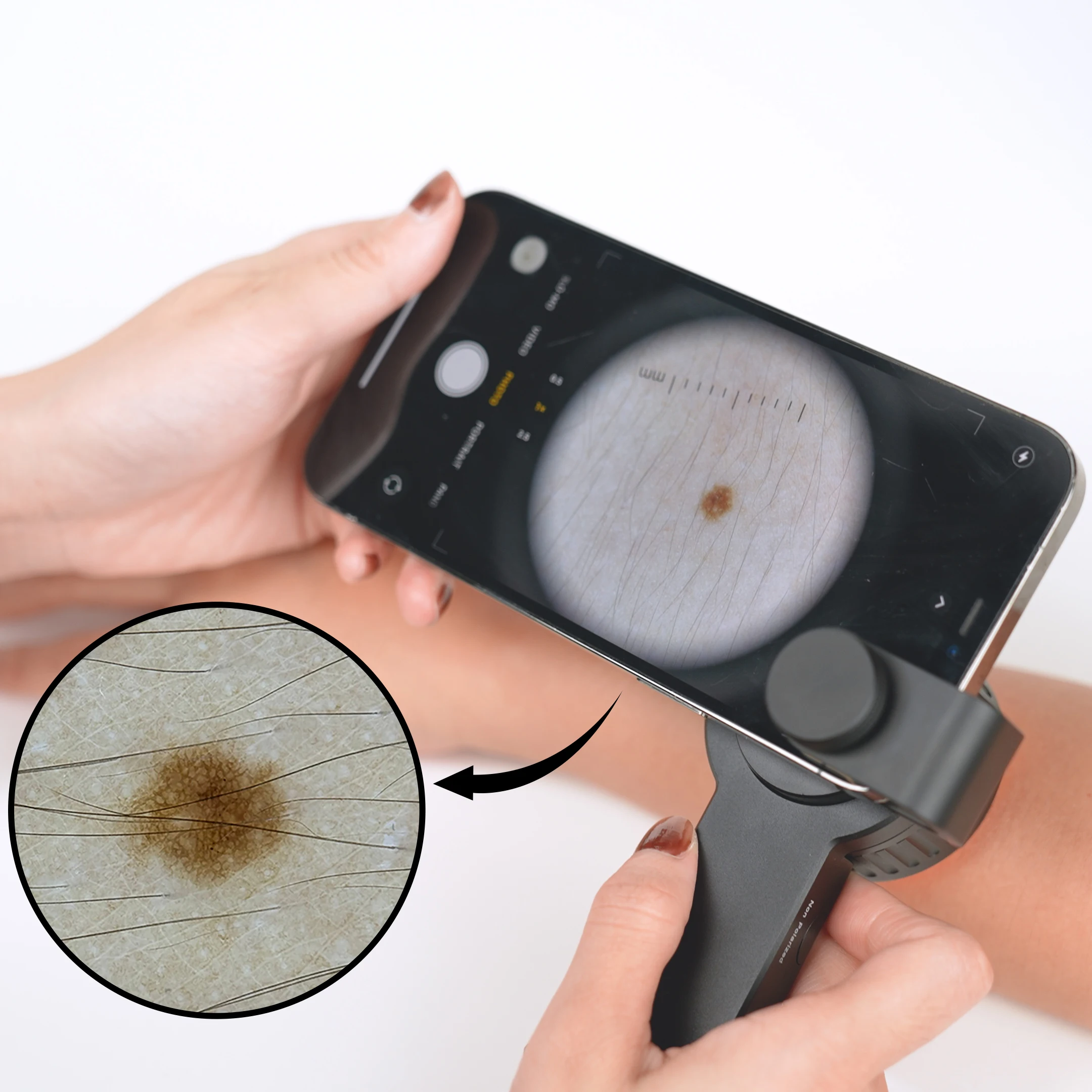 Дерматоскоп IBOOLO DE 3100, ручное устройство для визуализации врачей для осмотра волос на коже, ногтей, дермоскоп
Дерматоскоп IBOOLO DE 3100, ручное устройство для визуализации врачей для осмотра волос на коже, ногтей, дермоскоп