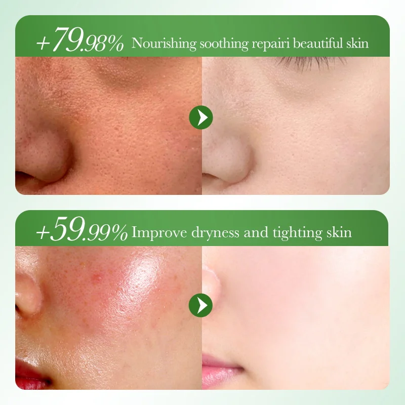 BIOAOUA Brand-new Hydrating And Soothing Aloe Vera Facial Hydrating Skin Gel Rejuvenating Facial Mushroom Cream Care Beauty H9C9
BIOAOUA Brand-new Hydrating And Soothing Aloe Vera Facial Hydrating Skin Gel Rejuvenating Facial Mushroom Cream Care Beauty H9C9