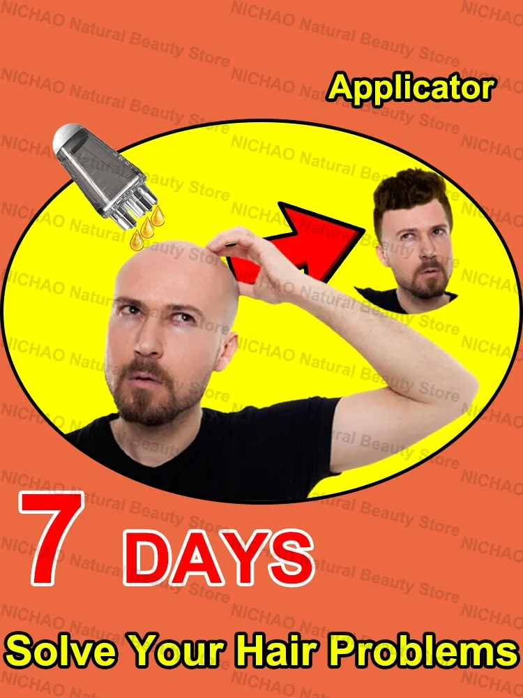 7 Days Fast Hair Growth Essential Loss Regrowth Treatment Strengthens Hair Nourishes Scalp Light Weight Non Greasy
7 Days Fast Hair Growth Essential Loss Regrowth Treatment Strengthens Hair Nourishes Scalp Light Weight Non Greasy