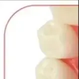 Стоматологические заболевания пародонта, демонстрационная модель зубов, 5-ступенчатая трехмерная пропорциональная конструкция увеличения для стоматолога
Стоматологические заболевания пародонта, демонстрационная модель зубов, 5-ступенчатая трехмерная пропорциональная конструкция увеличения для стоматолога