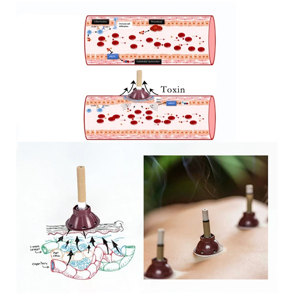 Slimming Burning Column Portable Weight Loss Products Chinese Medicine Physiotherapy Promote Fat Dissolution Slim Supplies
Slimming Burning Column Portable Weight Loss Products Chinese Medicine Physiotherapy Promote Fat Dissolution Slim Supplies