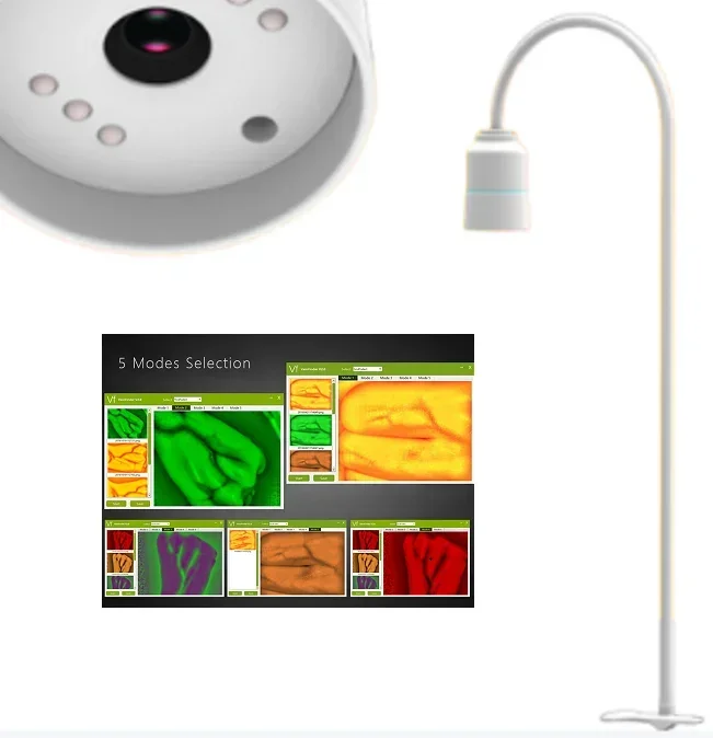 2026MC409 High technology clear image portable vein finder and display instrument for face lift, arm and leg
2026MC409 High technology clear image portable vein finder and display instrument for face lift, arm and leg