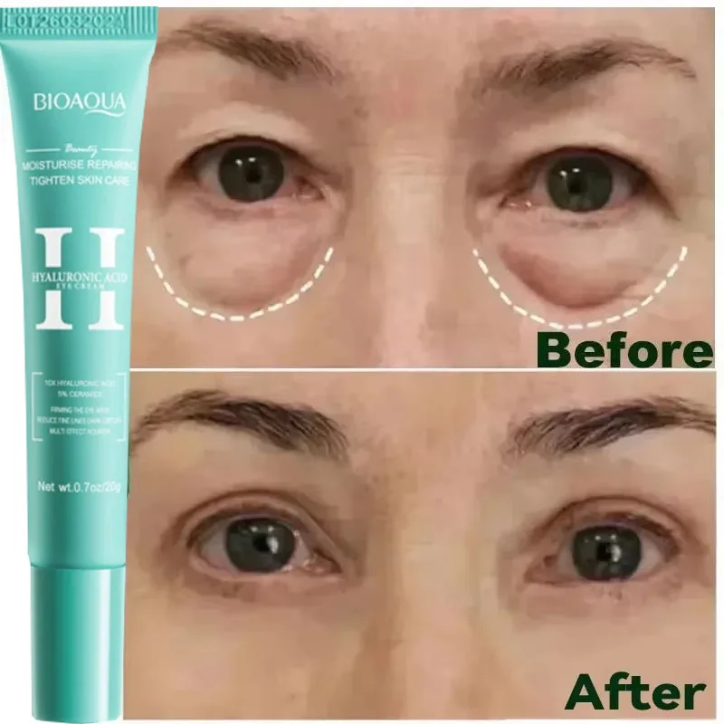 Instant Eye Bag Removal Cream Collagen Anti-Wrinkle Fade Fine Lines Firming Skin Anti Dark Circle Puffiness Brighten Eye Care
Instant Eye Bag Removal Cream Collagen Anti-Wrinkle Fade Fine Lines Firming Skin Anti Dark Circle Puffiness Brighten Eye Care