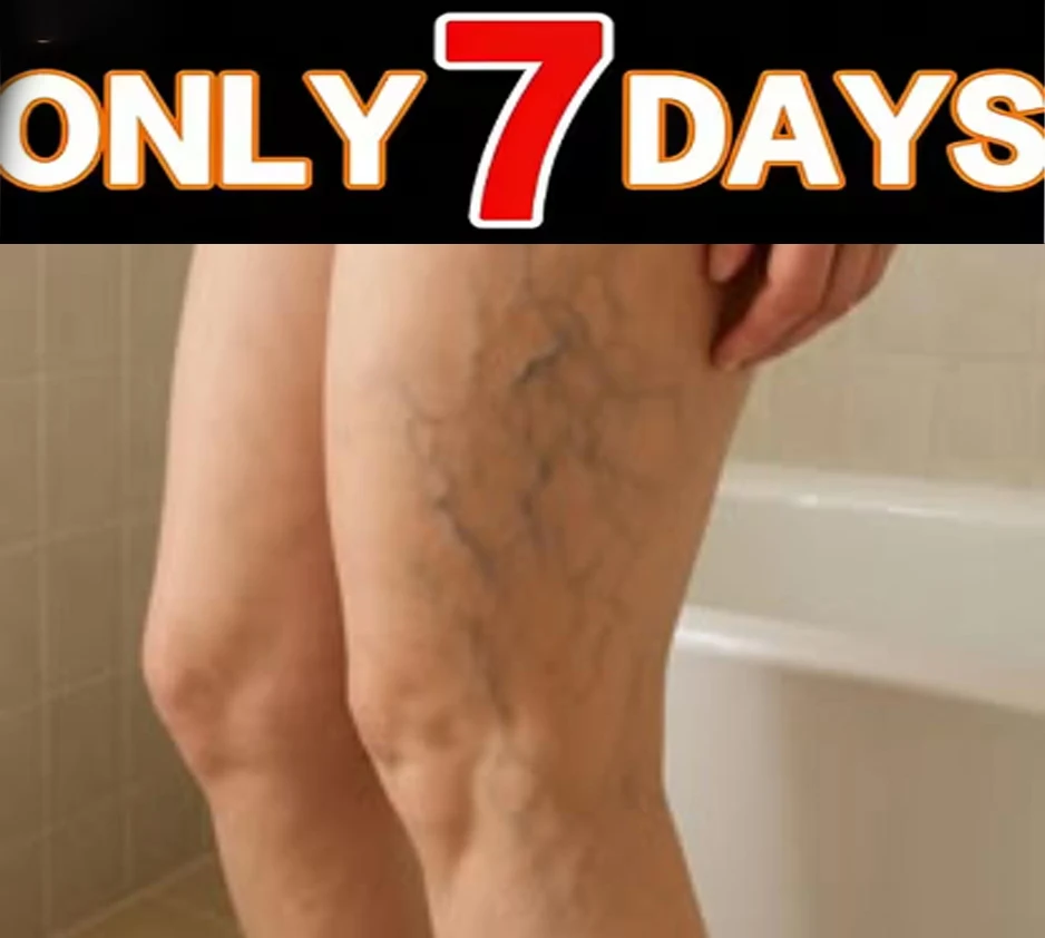 Ointment for Varicose Veins Eliminate Vasculitis Phlebitis to Relieve Spider Leg Pain Treatment Herbal cream
Ointment for Varicose Veins Eliminate Vasculitis Phlebitis to Relieve Spider Leg Pain Treatment Herbal cream