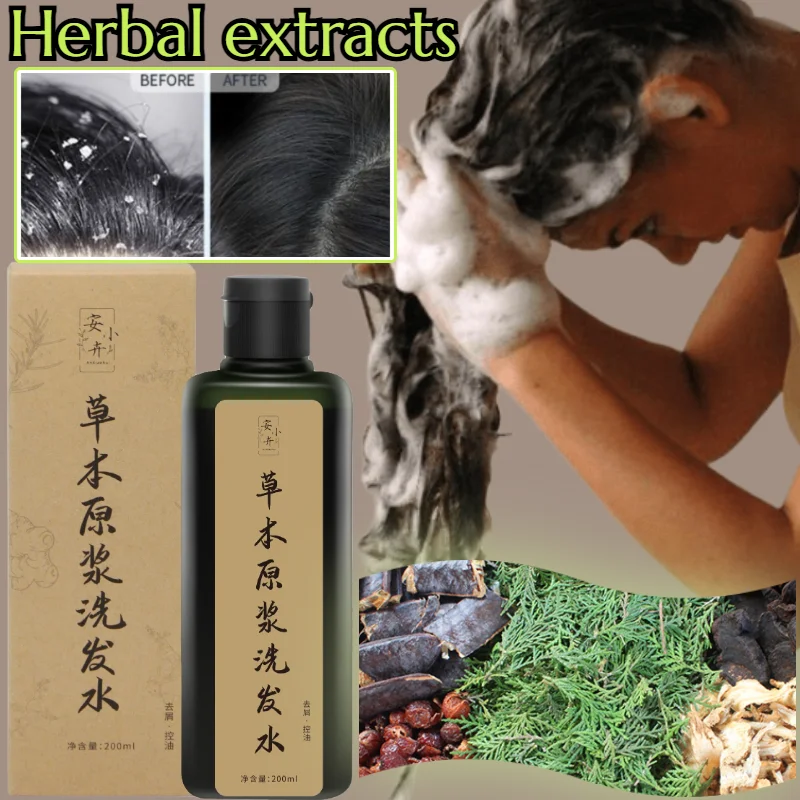 Plant Shampoo Puree 14 Flavors Herbal Hair Care Improves Hair Quality Oil Control Anti-Dandruff Silicone Oil-Free Plant Shampoo
Plant Shampoo Puree 14 Flavors Herbal Hair Care Improves Hair Quality Oil Control Anti-Dandruff Silicone Oil-Free Plant Shampoo