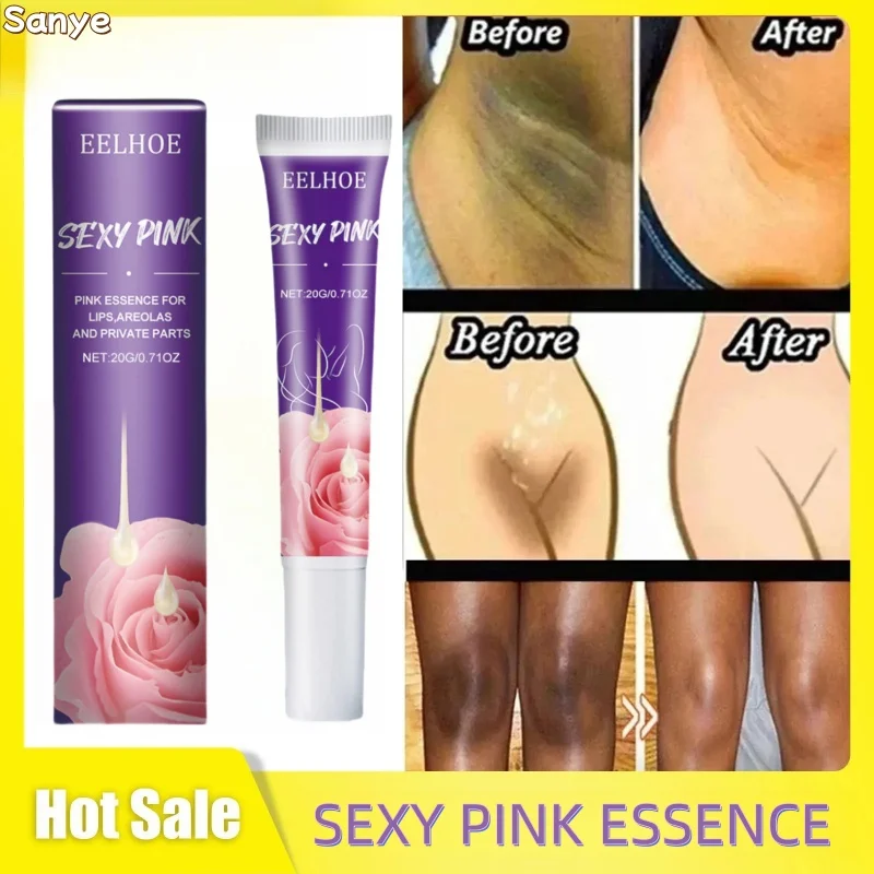 Brightening Cream For Intimate Parts Body Knees Remove Dull of Underarm Elbow Knees bleach essence moisturizing fade dark spots
Brightening Cream For Intimate Parts Body Knees Remove Dull of Underarm Elbow Knees bleach essence moisturizing fade dark spots