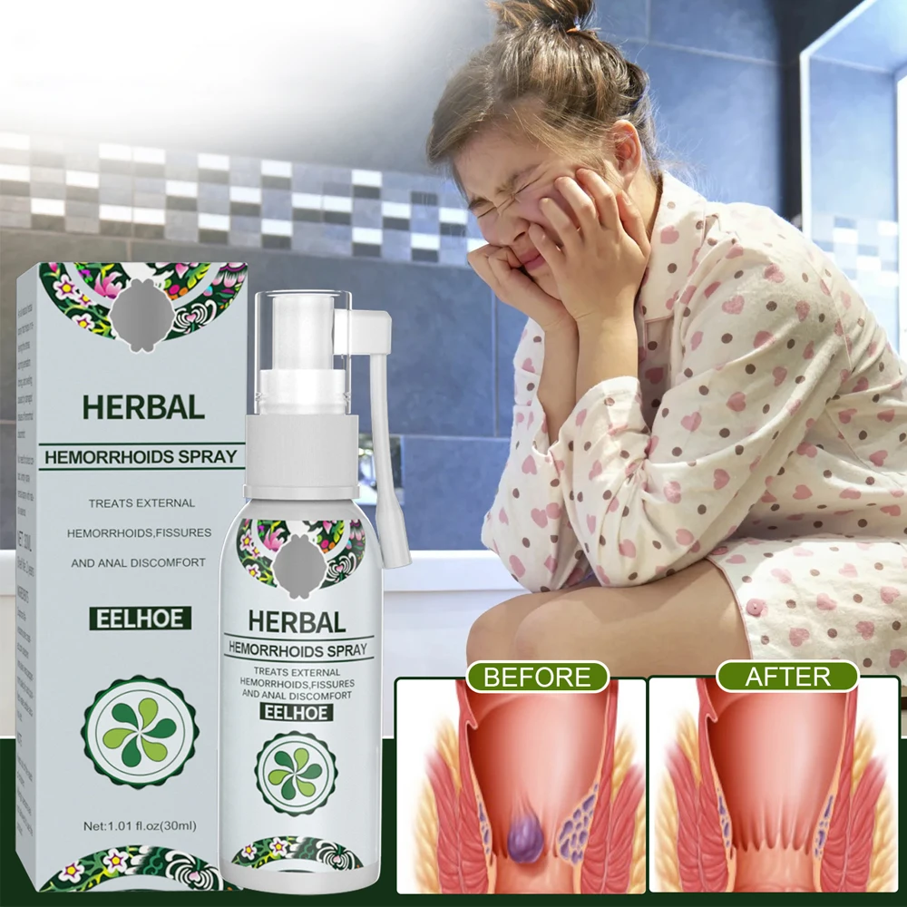 30ml Hemorrhoid Spray Herbal Cream Anal Care Relieves Swelling Painless Itching Discomfort Redness Symptoms