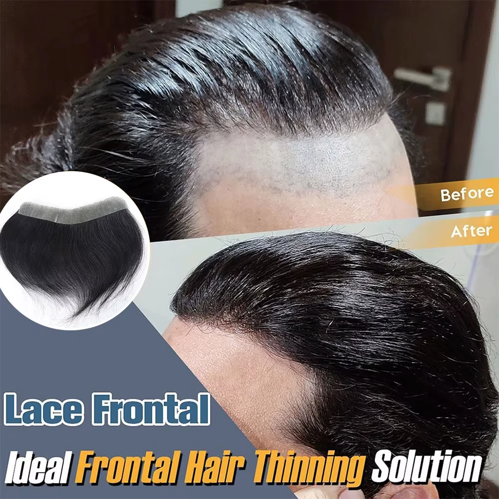 Natural Human Hair Forehead Hairline Toupee Men's Capillary Prosthesis Thin Skin Hairpiece Replacement System Remy Hair