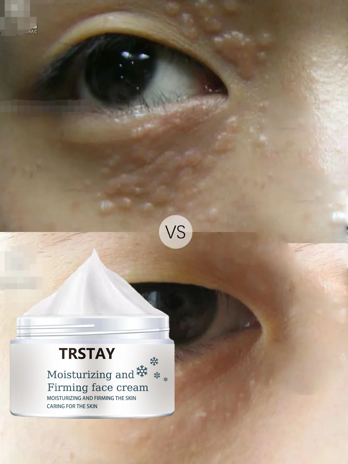 Moisturizing Soft Smooth Eye Cream Gently Disperses Small Bumps For Silky Smooth Glossy Eye Area While Soothing Brightening Deli