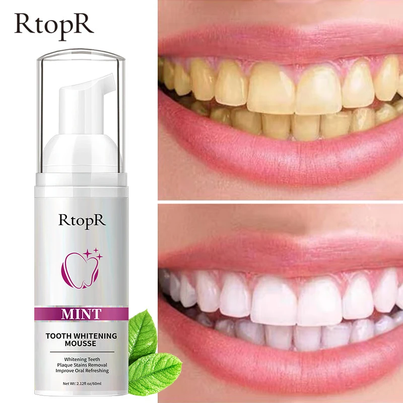 RtopR Teeth Whitening Remove Smoke Stains Coffee Stains Mousse Fresh Breath Bad Breath Clean Teeth Stains Dazzle White Teeth