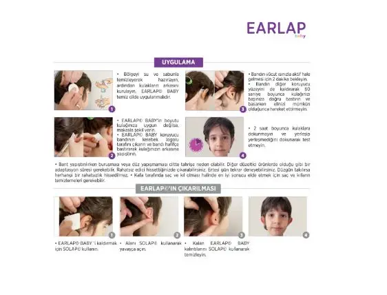 EARLAP Baby 3-12 Months Ear Concealer Aesthetic The Protruding Ear For Bands That Adheres Instantly Effect Ear Trimmer