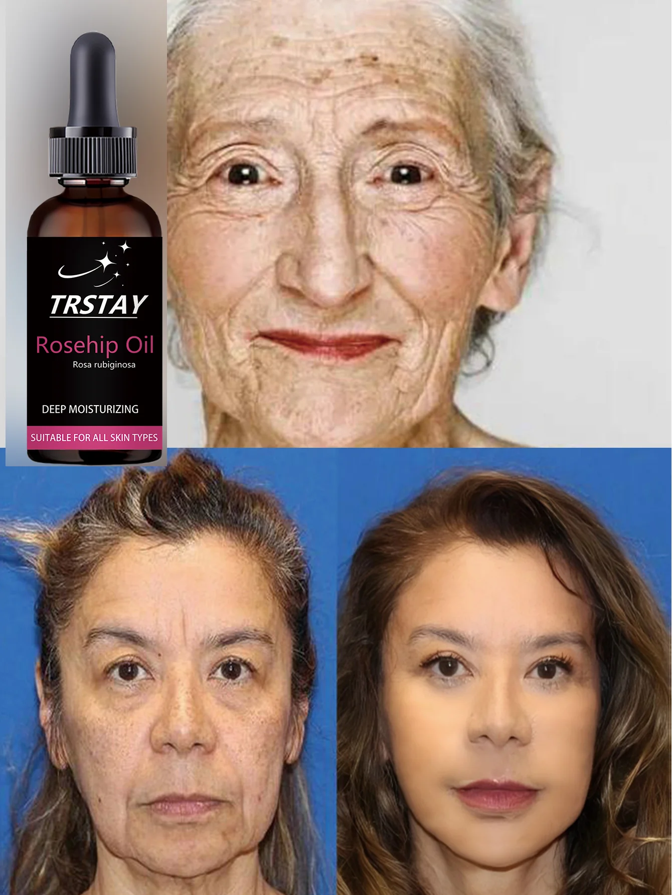 

Интенсивная восстанавливающая ночная сыворотка против старения, лифтинговое лечение, глубокое увлажнение, фиксирующая вода для заполнения клеток для мягкой эластичной кожи Overn