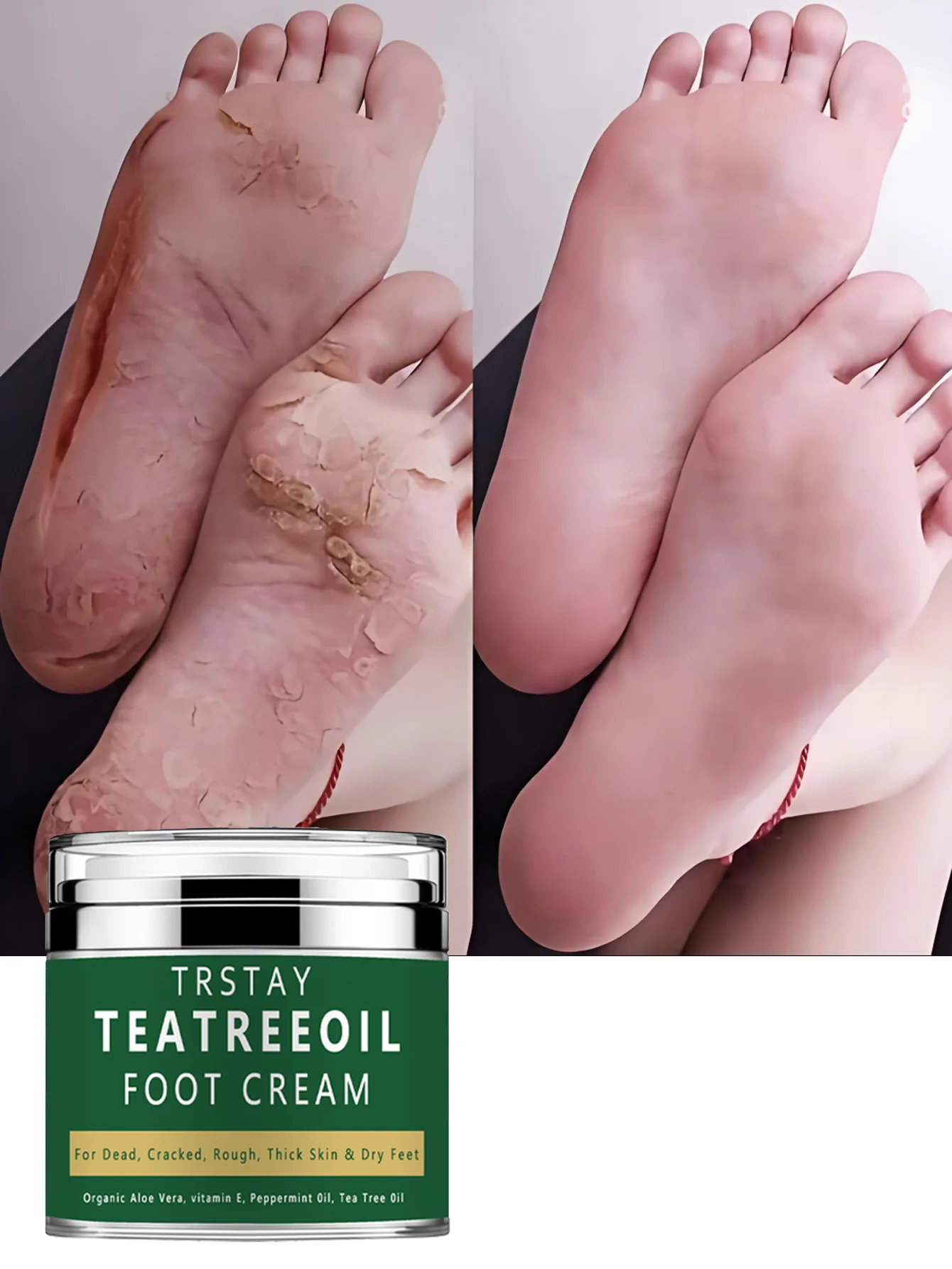 

Увлажняющий уход за ногами для сухой и потрескавшейся кожей. Профессиональное средство для удаления кожи. Для создания ваших ног. Нежный и мягкий, как новый.