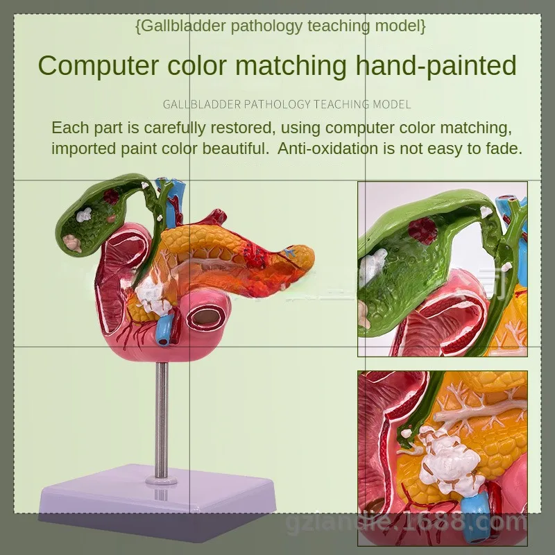 Modelo de vesícula biliar de duodeno pancreas com navios, biologia, modelo anatômico de corpo humano em tamanho real para nervos, ajuda de laboratório de ensino escolar