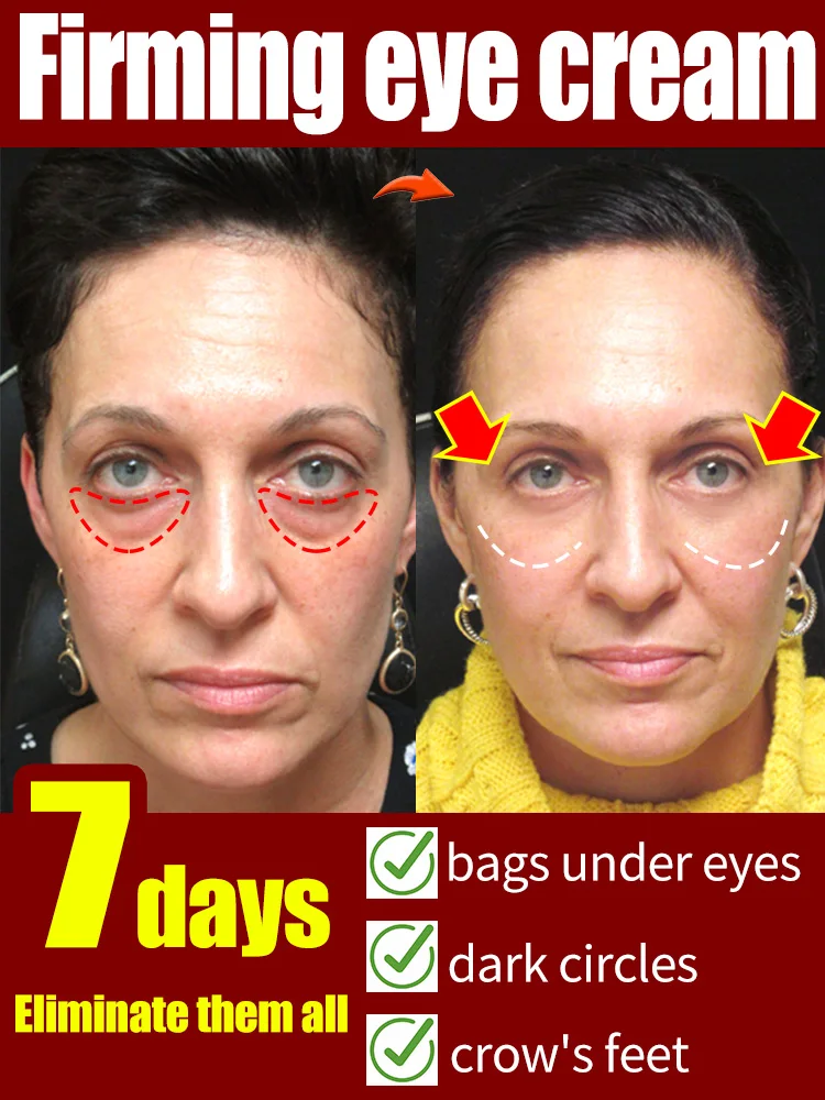 

Eye cream Under eye Bag Puffy Fat Removal