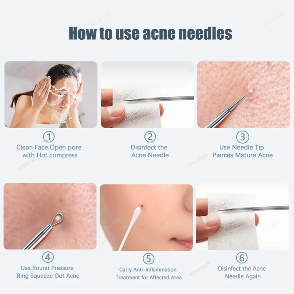 Blackhead Clip Pimple Remover Tool Acne Needle Extraction Popper Pore Black Head Cleaner Face Skin Care Deep Cleansing Needle