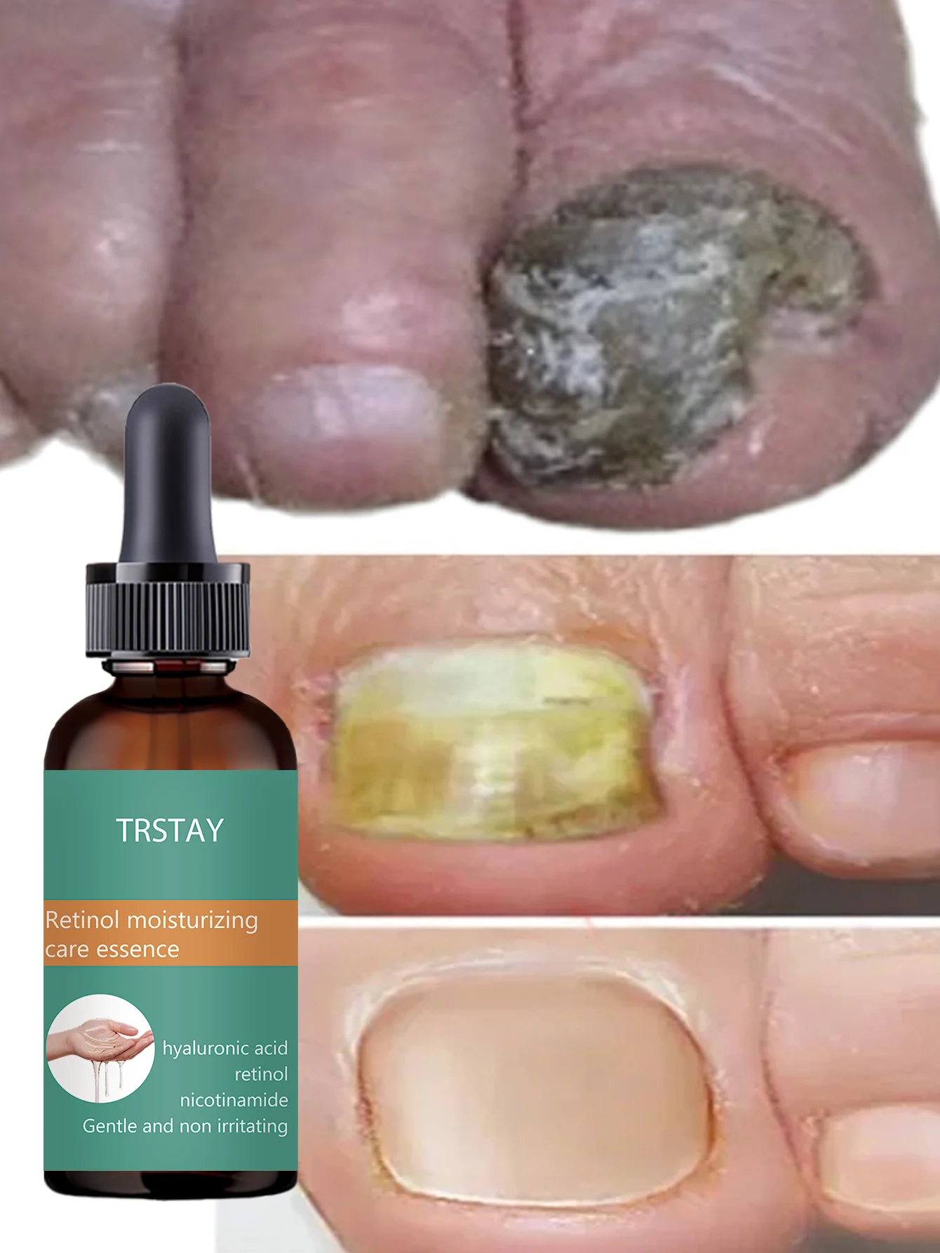 Cuticle Oils and Nail Strengthener Repair Treatment for Fragile Nails Moisturize Nourish Multiple Sizes Healthy Strong Beautiful - Image 4