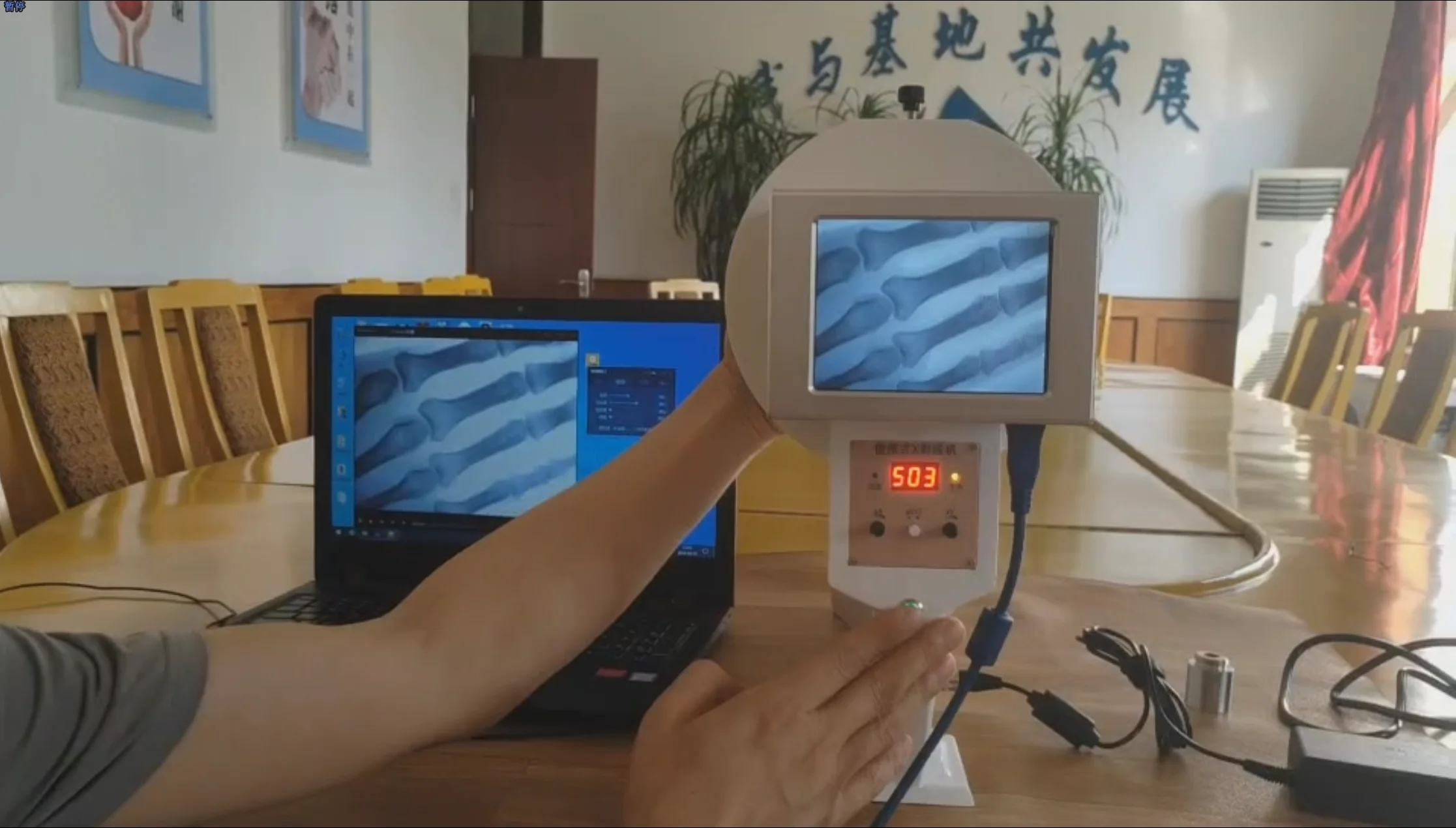 

Digital x ray machine price Perspective machine portable x ray machine