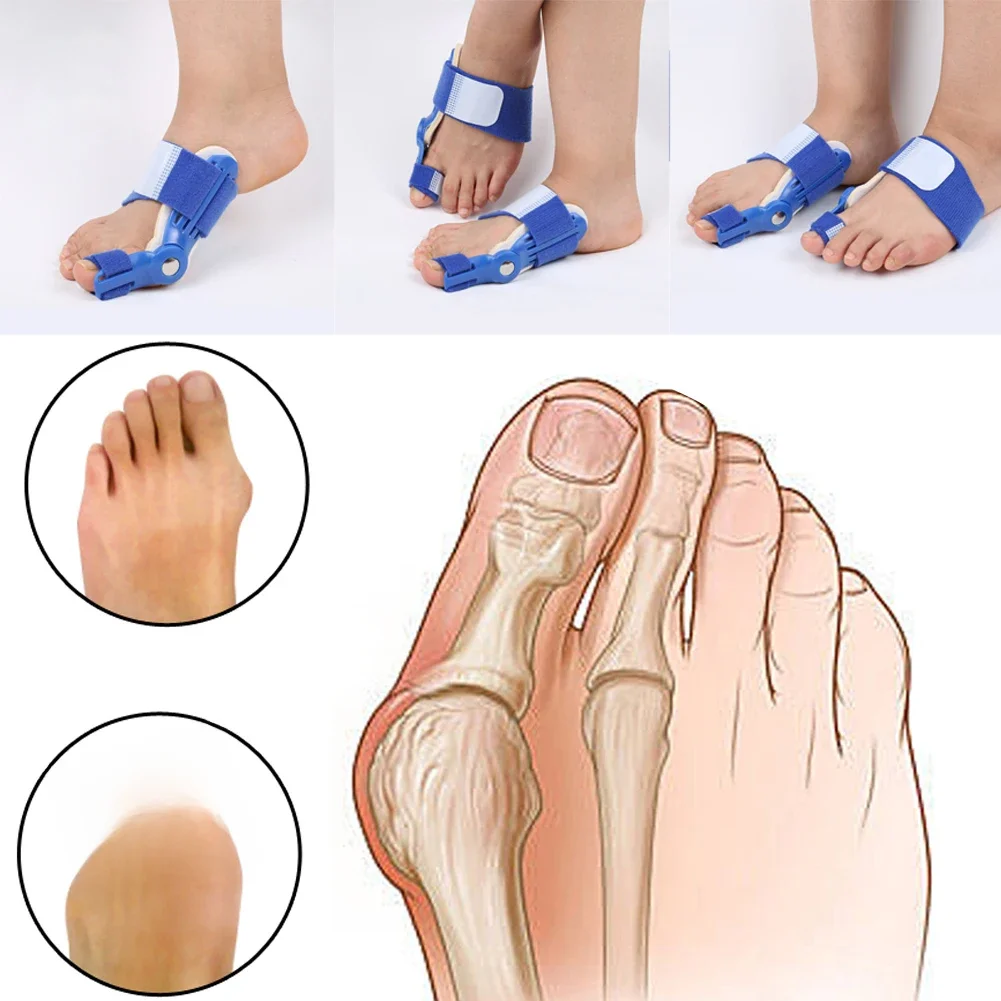 Orthèses correcteur de gros orteils Hallux Valgus soulagement de la douleur des pieds garde soin os correcteur oignon nuit jour attelle lisseur