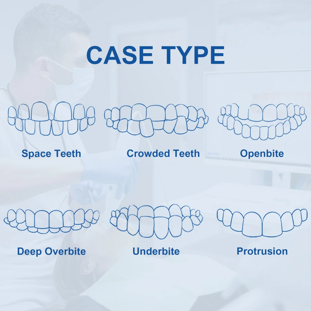 Dentystyczny przezroczysty silikonowy odcisk do utwardzania światłem żywicy przewodnik ortodontyczny łączący wcisk implantu przezroczysty materiał