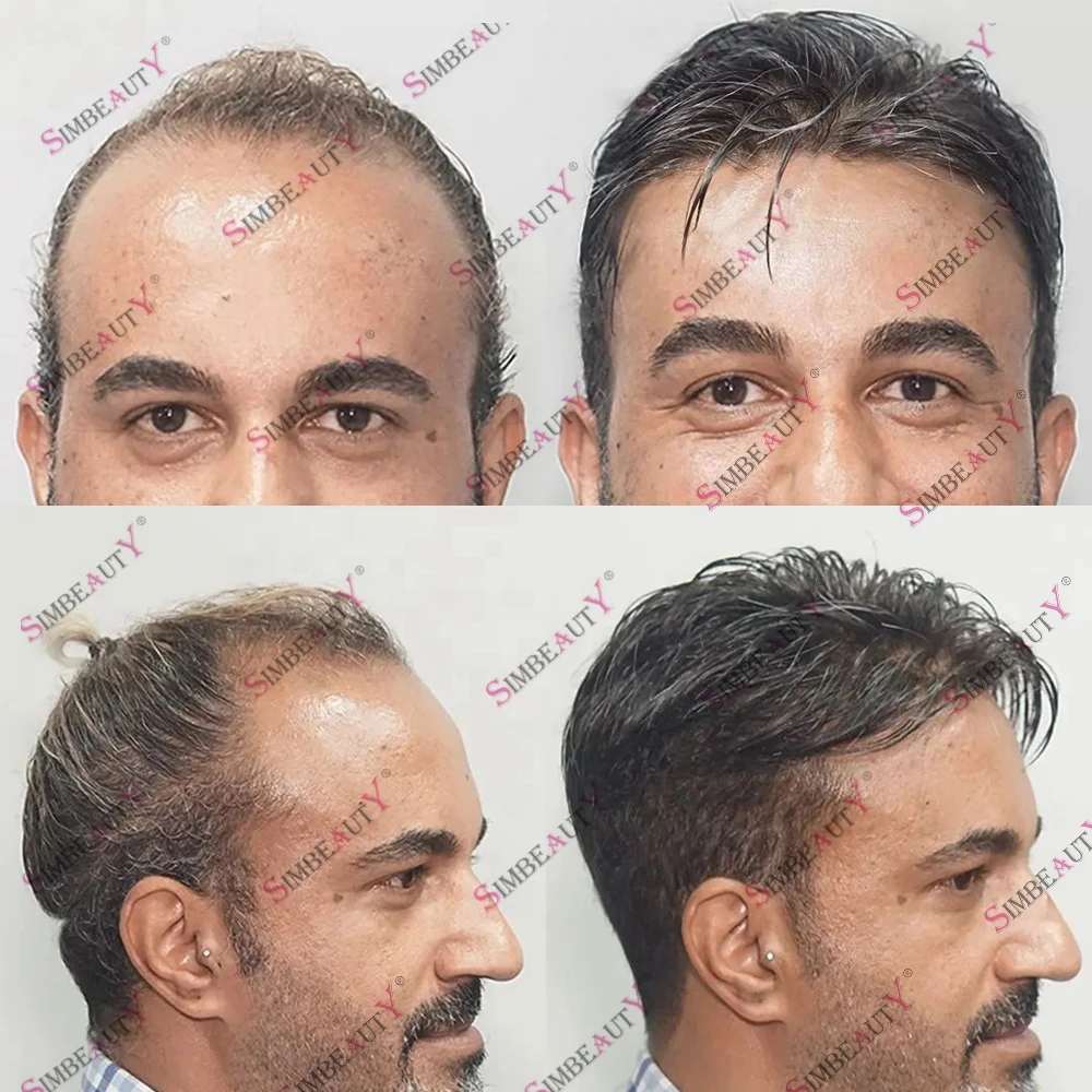 Sistema de prótese capilar para substituição de pêlos, toupee para homens, 0,1mm fino, super durável cabelo humano, acessível