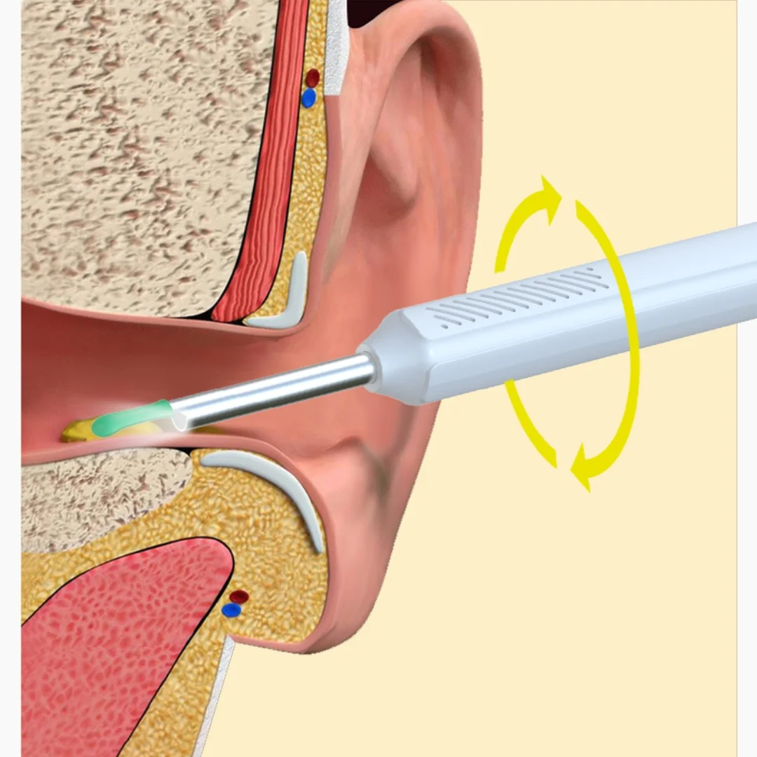 Visual earwax cleaner with camera, high-definition ear scoop, mobile application viewing, 1080P high-definition resolution, wire