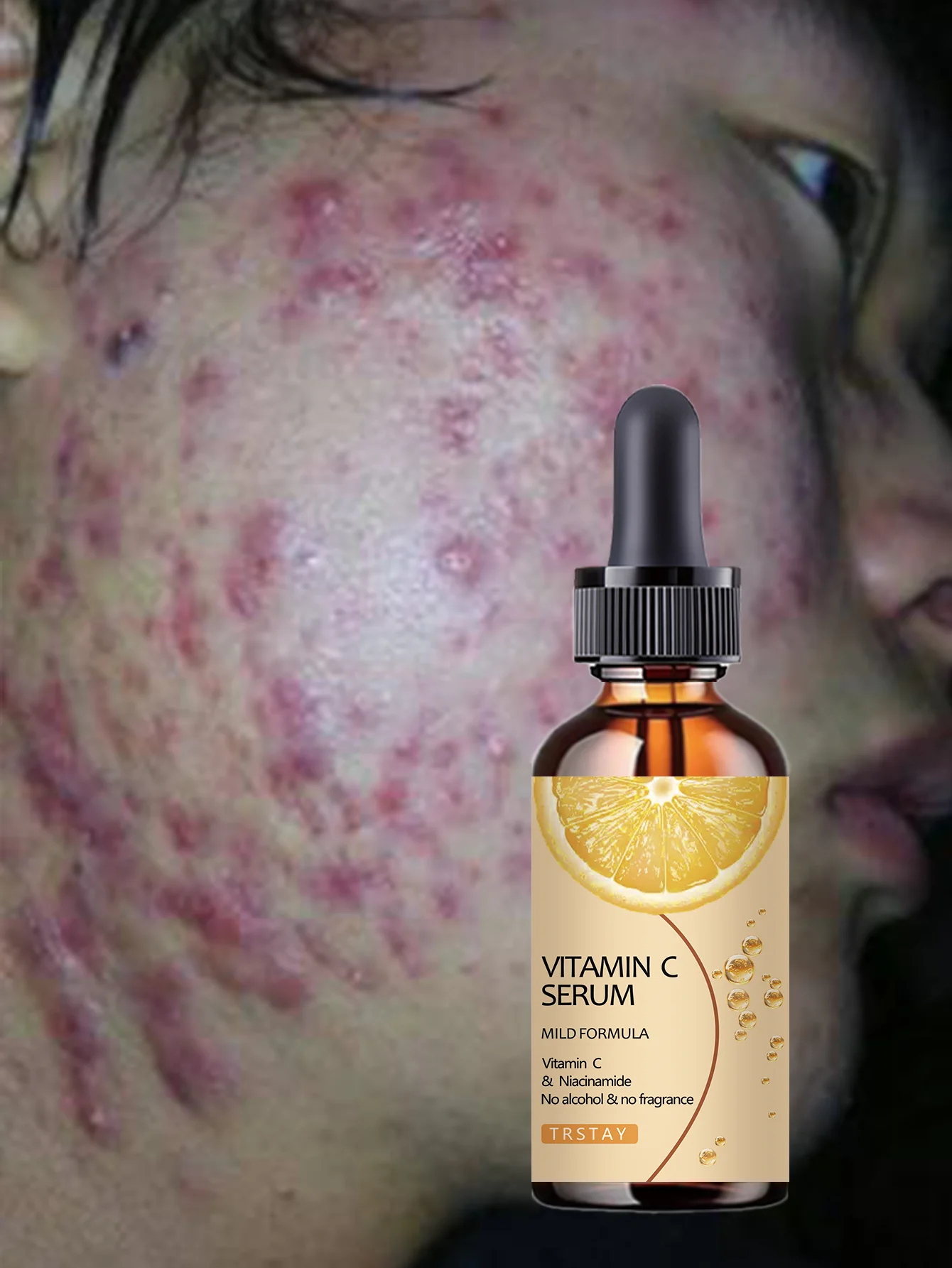 Hydrating Lightweight Serum Deeply Moisturizes Enhances Skin Firmness Creates Plump Youthful Skin Smooth Soothing Treatment for - Image 5